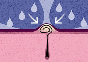 In The Beauty Light: Ingrown Hair